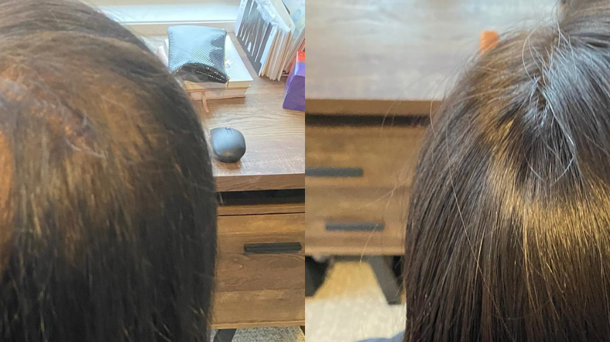 Did you know you can get a FREE Topper or Wig if you have certain medical conditions?