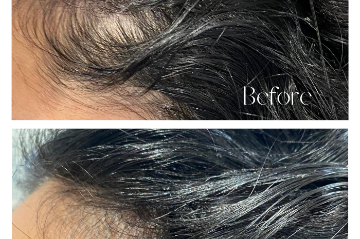 Hair Extensions Invisible Cover-Up Hair Patches - The Extension Bar