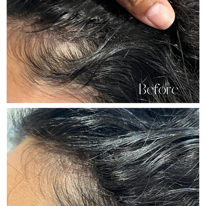 Hair Extensions Invisible Cover-Up Hair Patches - The Extension Bar