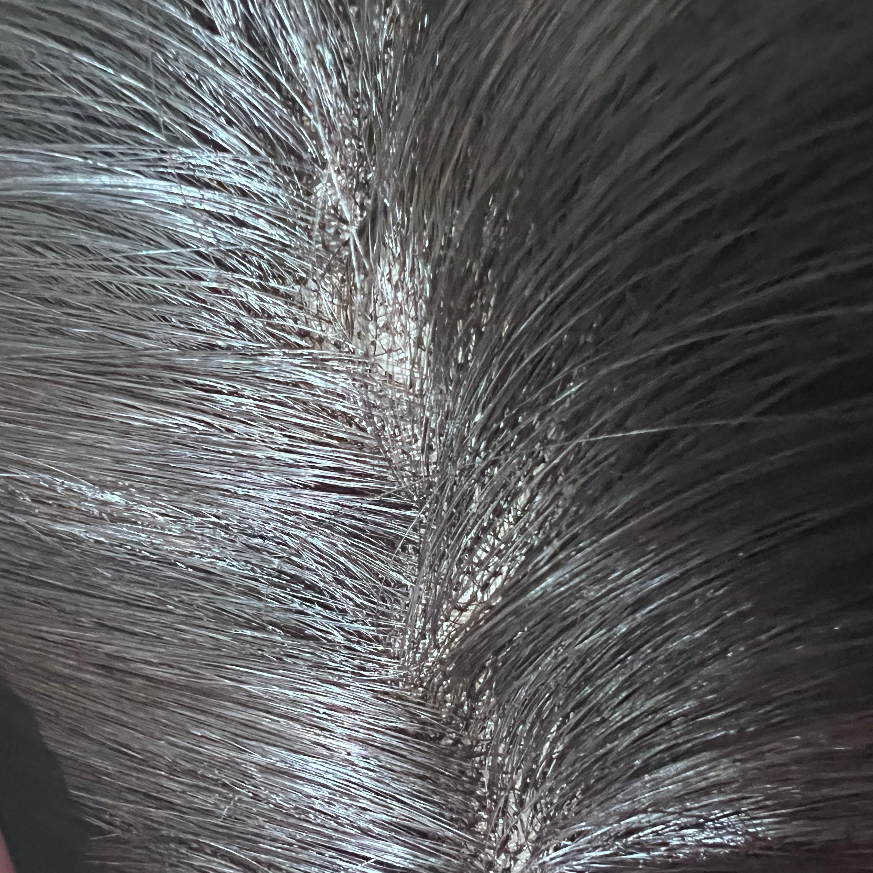 Lace Base Hair Topper