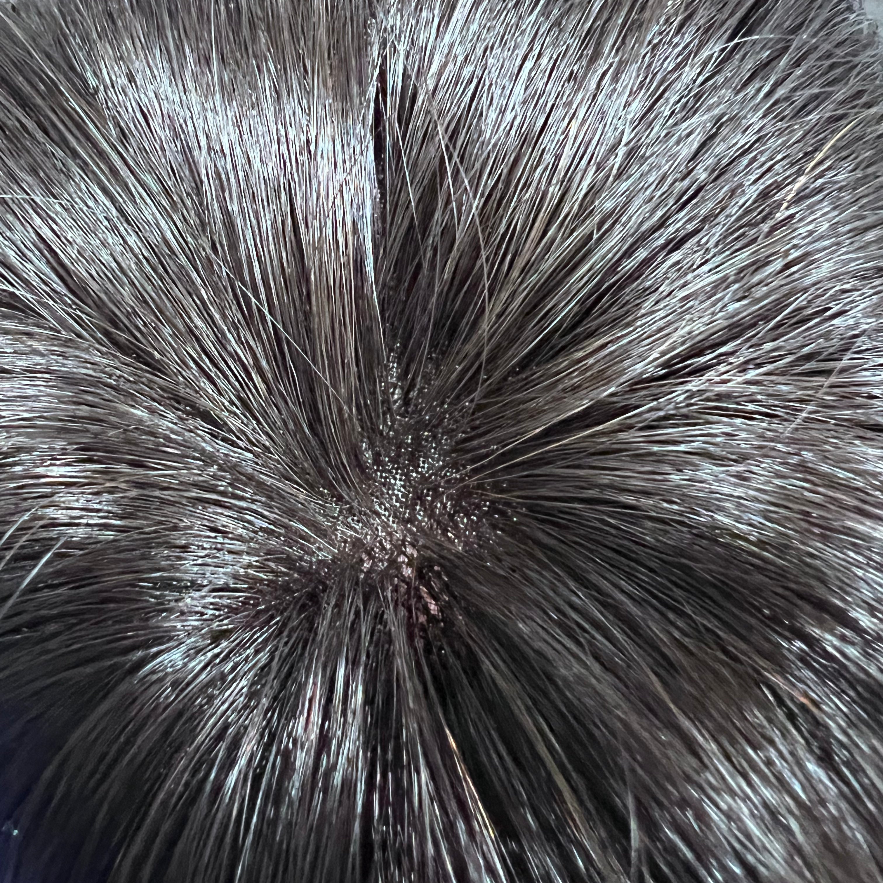 Lace Base Hair Topper